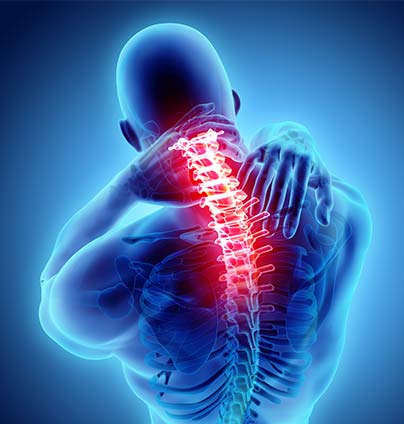 Spinal Arthritis Treatment at InovoSpine, Located in Houston TX