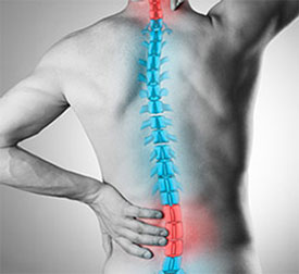 Arthritis Of The Spine at InovoSpine, Located in Houston TX