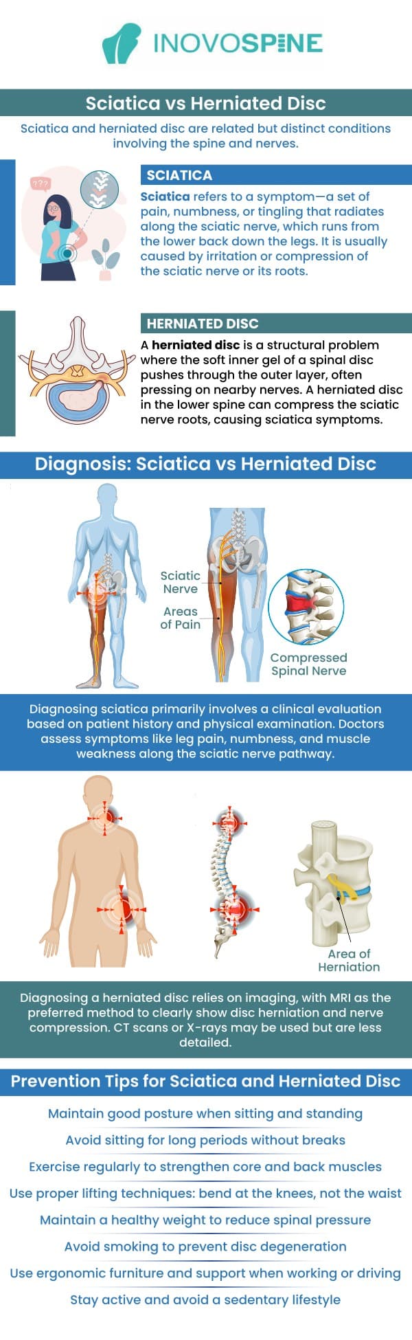 At Inovo Spine, Dr. Pawan Grover specializes in diagnosing and treating complex spine conditions such as herniated discs and sciatica. These two issues often share similar symptoms—like lower back pain, numbness, or leg tingling—but require distinct treatment approaches. We use advanced imaging and diagnostic techniques to pinpoint the exact cause of your pain, ensuring a precise and effective care plan. For more information, contact us or book an online appointment. We are conveniently located at 1140 Business Center Dr, Suite 110, Houston TX 77043.